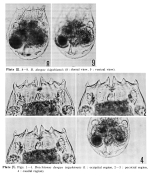 Brachionus durgae isigakiensis - Original description image