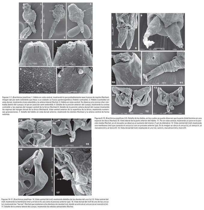 Brachionus josefinae