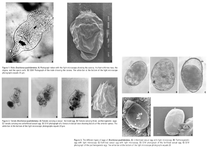 Brachionus quadridentatus