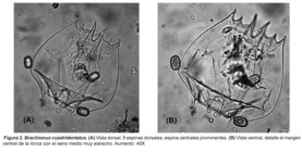 Brachionus quadridentatus