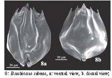 Brachionus rubens Brachionus rubens