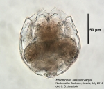 Brachionus sessilis