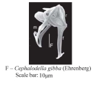 Cephalodella gibba
