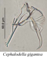 Cephalodella gigantea