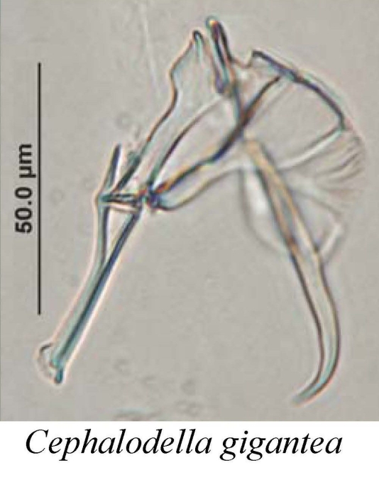 Cephalodella gigantea