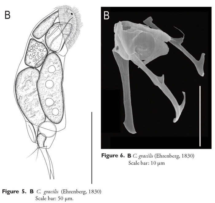 Cephalodella gracilis