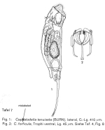 Cephalodella tenuiseta