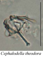 Cephalodella theodora