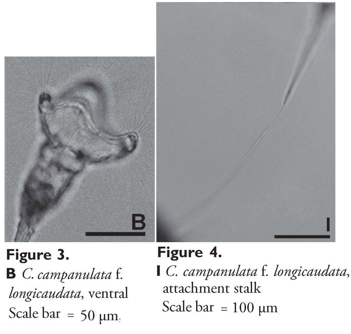 Collotheca campanulata var. longicaudata Collotheca campanulata var. longicaudata