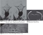 Collotheca ferox