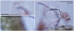 Collotheca orchidacea