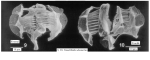 Conochilus dossuarius