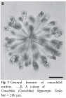 Conochilus hippocrepis