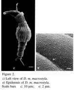 Dissotrocha macrostyla