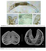Embata laticeps