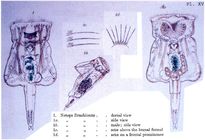 Epiphanes brachionus