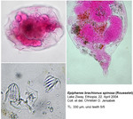 Epiphanes brachionus spinosa