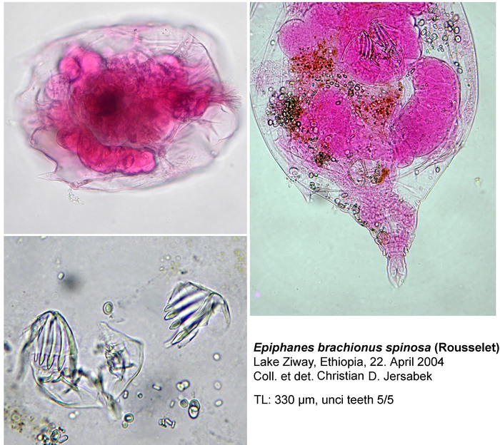 Epiphanes brachionus spinosa