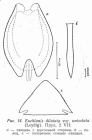 Euchlanis dilatata f. unisetata