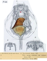 Euchlanis pyriformis