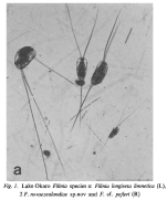 Filinia limnetica