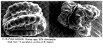 Filinia longiseta