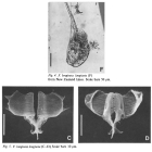 Filinia longiseta