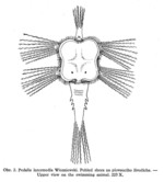 Hexarthra intermedia