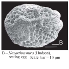 Hexarthra mira
