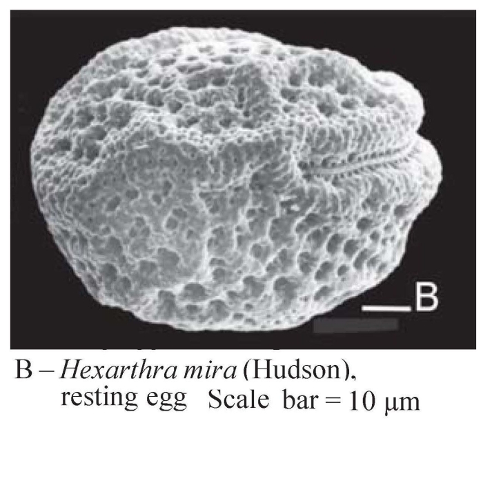 Hexarthra mira Hexarthra mira