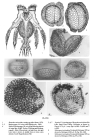 Hexarthra mira