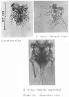 Hexarthra mira