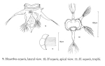 Hexarthra oxyure