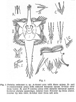 Hexarthra reducens