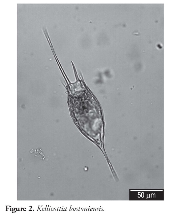 Kellicottia bostoniensis Kellicottia bostoniensis