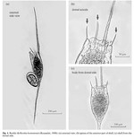 Kellicottia bostoniensis