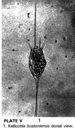 Kellicottia bostoniensis