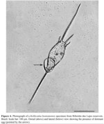 Kellicottia bostoniensis