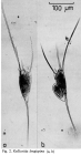 Kellicottia longispina