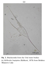 Kellicottia longispina