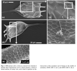 Keratella cochlearis
