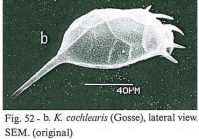 Keratella cochlearis