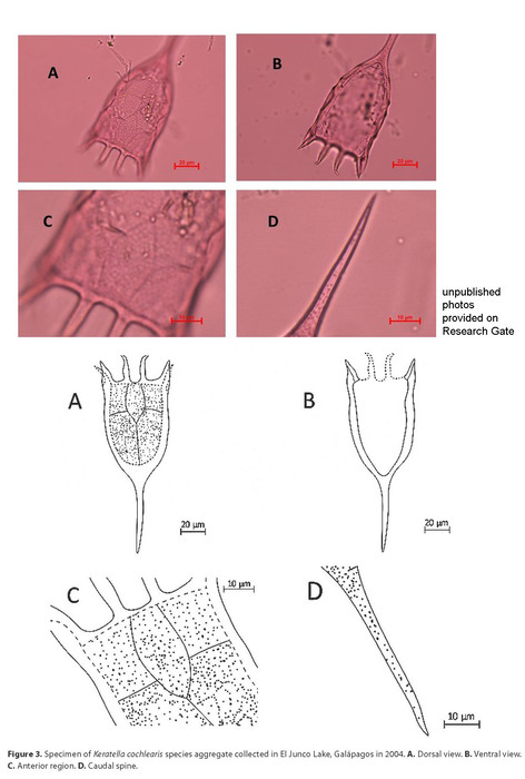 Keratella cochlearis Keratella cochlearis