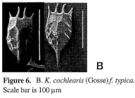 Keratella cochlearis