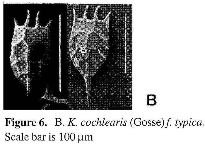 Keratella cochlearis Keratella cochlearis