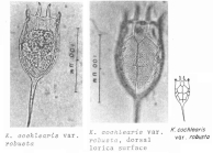 Keratella cochlearis f. robusta
