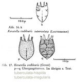Keratella cochlearis f. tuberculata