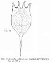Keratella cochlearis var. hispida