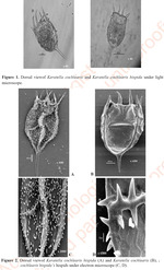 Keratella cochlearis var. hispida