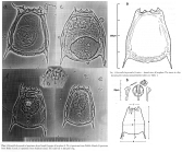 Keratella heywoodi